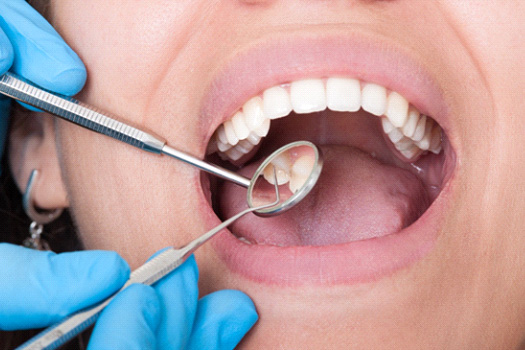 Woman having teeth examined