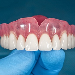 Model showing partial denture replacing several missing teeth