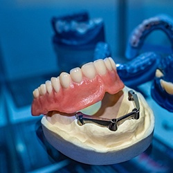 Dentist holding a full upper denture