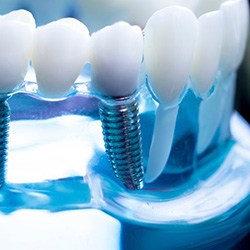 Close up of dental implants in a resin display case