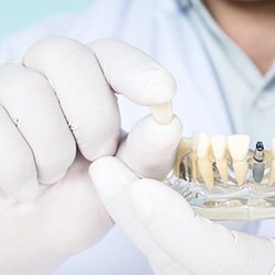 Dentist holding a dental implant model and crown